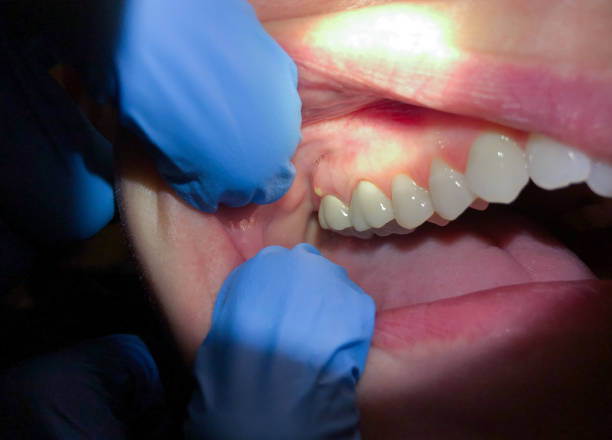 Best Urgent Dental Care for Toothache in Haymarket, VA